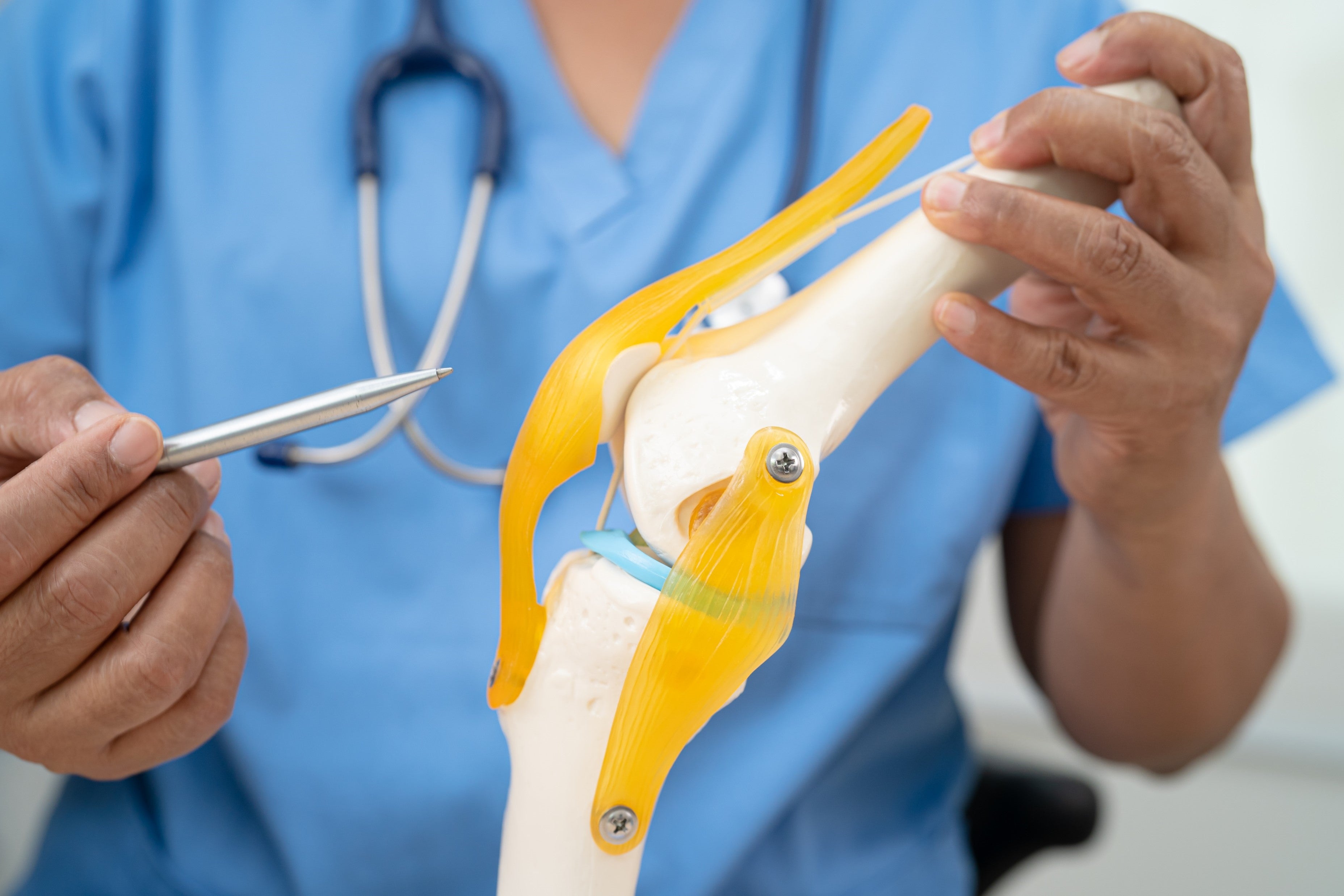 Comparativa de niveles de fuerza en cuádriceps tras autoinjerto & injerto de cadáver del LCA