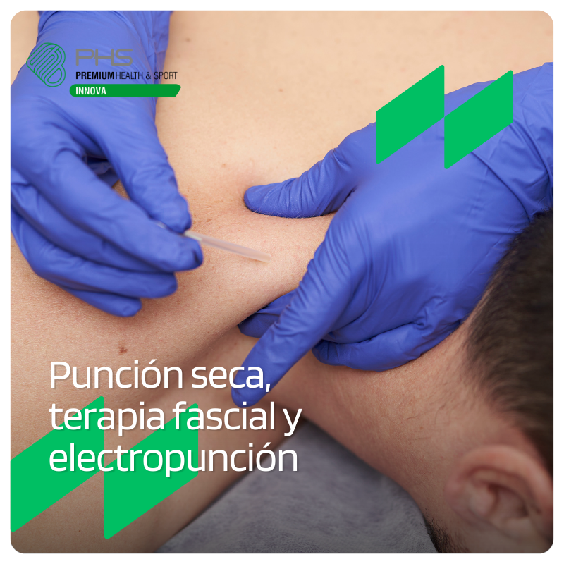 Punción Seca, Electro punción y terapia fascial - EDICIÓN XIX - (Copia)